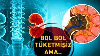 Böbrek taşının bu belirtilerine dikkat - görsel 2