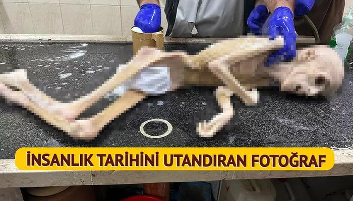 Filistin'de insanlık tarihine leke sürecek bir fotoğraf!  Her geçen gün yıprandı, bir deri bir kemik kaldı: "Oğlumun böyle olacağını hiç düşünmemiştim."