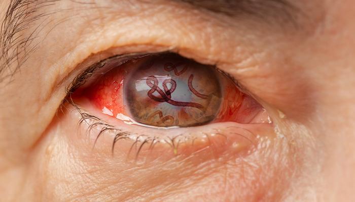 Korkunç hastalık: Resmen içerden çürütüyor! Ebola benzeri virüs 8 kişinin canını aldı