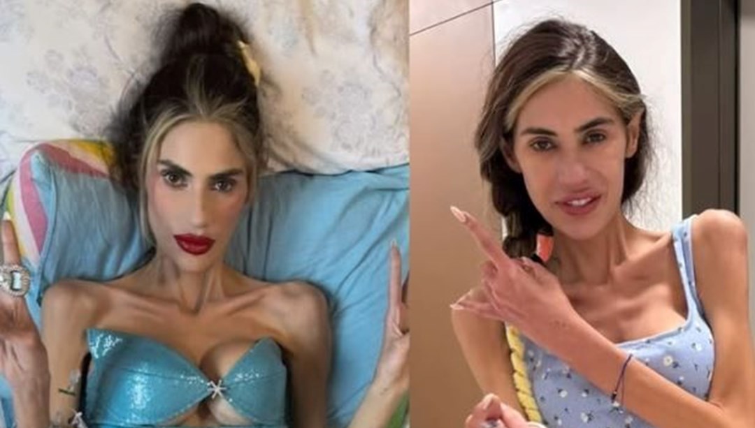 Nihal Candan "öldü" paylaşımlarına yanıt geldi: Nihal Candan kimdir, hastalığı ne?